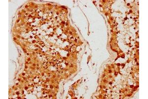 IHC image of ABIN7159140 diluted at 1:500 and staining in paraffin-embedded human testis tissue performed on a Leica BondTM system. (MED26 Antikörper  (AA 372-523))