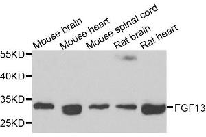 Western blot analysis of extracts of various cells, using FGF13 antibody. (FGF13 Antikörper)