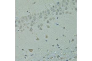 Immunohistochemistry of paraffin-embedded rat brain using IVNS1ABP antibody (ABIN1873334) at dilution of 1:100 (40x lens). (IVNS1ABP Antikörper)