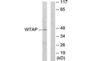 Western blot analysis of extracts from HuvEc cells, using WTAP Antibody. (WTAP Antikörper  (AA 321-370))