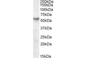 ABIN263185 (1µg/ml) staining of human cerebellum lysate (35µg protein in RIPA buffer). (CHRNB1 Antikörper  (Internal Region))