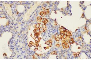 Immunohistochemistry of paraffin-embedded Rat lung using ANXA5 Ployclonal Antibody at dilution of 1:100. (Annexin V Antikörper)