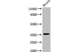 Western Blot Positive WB detected in: Mouse brain tissue All lanes: MNAT1 antibody at 3 μg/mL Secondary Goat polyclonal to rabbit IgG at 1/50000 dilution Predicted band size: 36, 32 kDa Observed band size: 36 kDa (MNAT1 Antikörper  (AA 1-309))