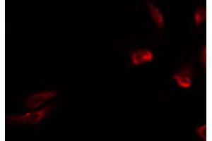 ABIN6274731 staining HeLa by IF/ICC. (MRPL15 Antikörper  (Internal Region))