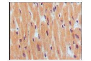 Immunohistochemical analysis of paraffin-embedded human normal myocardium, showing cytoplasmic localization using BNP1 mouse mAb with DAB staining.
