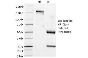 SDS-PAGE Analysis Purified CK17 Mouse Monoclonal Antibody (KRT17/778). (KRT17 Antikörper)