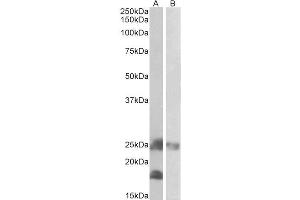 Western Blotting (WB) image for anti-Dynactin 3 (p22) (Dctn3) (Internal Region) antibody (ABIN571258)