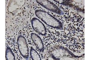 Image no. 1 for anti-RAB GTPase Activating Protein 1-Like (RABGAP1L) (AA 1-111) antibody (ABIN599499) (RABGAP1L Antikörper  (AA 1-111))