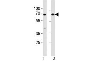 Western blot analysis of lysate from mouse (1) small intestine and (2) testis tissue lysate using Klf4 antibody at 1:1000.