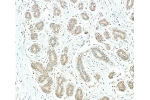 Immunohistochemistry (IHC) image for anti-Proteasome (Prosome, Macropain) 26S Subunit, Non-ATPase, 1 (PSMD1) (AA 903-953) antibody (ABIN7453570)