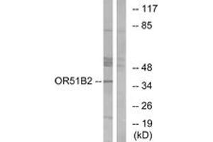 Western Blotting (WB) image for anti-Olfactory Receptor, Family 51, Subfamily B, Member 2 (OR51B2) (AA 196-245) antibody (ABIN2891140) (OR51B2 Antikörper  (AA 196-245))