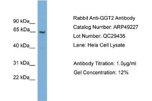 WB Suggested Anti-GGT2  Antibody Titration: 0.