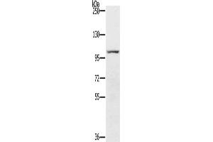 Gel: 6 % SDS-PAGE, Lysate: 40 μg, Lane: 293T cells, Primary antibody: ABIN7191822(PDE5A Antibody) at dilution 1/200, Secondary antibody: Goat anti rabbit IgG at 1/8000 dilution, Exposure time: 2 minutes