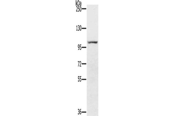 PDE5A antibody