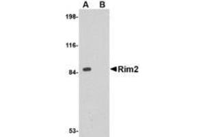 Image no. 1 for anti-Regulating Synaptic Membrane Exocytosis 2 (RIMS2) (Internal Region) antibody (ABIN1493812)