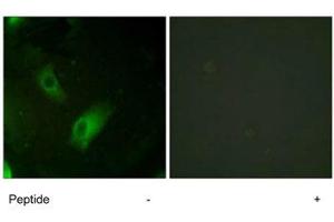 Immunofluorescence analysis of HeLa cells, using ACO1 polyclonal antibody . (Aconitase 1 Antikörper)