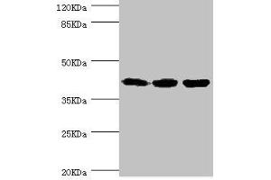 Western blot All lanes: FIBP antibody at 1. (FIBP Antikörper  (AA 1-364))