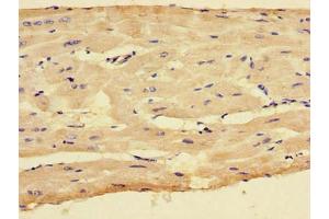 Immunohistochemistry of paraffin-embedded human heart tissue using ABIN7148772 at dilution of 1:100 (CX3CR1 Antikörper  (AA 298-351))