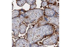 Immunohistochemical staining of human placenta with SNX22 polyclonal antibody  shows strong membranous positivity in trophoblastic cells at 1:500-1:1000 dilution.