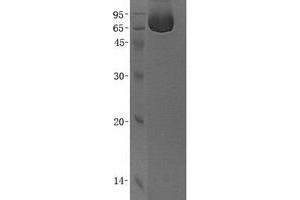 Validation with Western Blot (ANXA6 Protein (Transcript Variant 1) (His tag))