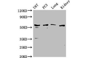 Western Blot Positive WB detected in: U87 whole cell lysate, PC3 whole cell lysate, Mouse lung tissue, Mouse kidney tissue All lanes: PPP5C antibody at 1:1000 Secondary Goat polyclonal to rabbit IgG at 1/50000 dilution Predicted band size: 57 kDa Observed band size: 57 kDa