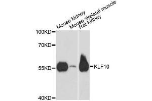 Western blot analysis of extracts of various cell lines, using KLF10 antibody. (KLF10/TIEG1 Antikörper  (AA 161-365))