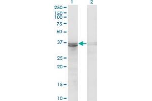 Western Blot analysis of FRZB expression in transfected 293T cell line by FRZB monoclonal antibody (M06), clone 3F4. (FRZB Antikörper  (AA 102-190))