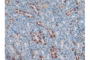 Immunohistochemistry (IHC) image for anti-S100 Calcium Binding Protein A6 (S100A6) (AA 1-89) antibody (ABIN7437005)