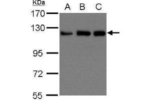 WB Image Sample (30 ug of whole cell lysate) A: 293T B: A431 , C: H1299 15% SDS PAGE antibody diluted at 1:1500 (KIF5B Antikörper  (C-Term))