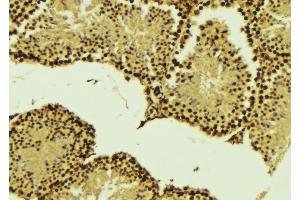 ABIN6268860 at 1/100 staining Mouse testis tissue by IHC-P. (Cyclin A1 Antikörper)