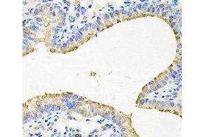Immunohistochemistry of paraffin-embedded Mouse lung using STRN3 Polyclonal Antibody at dilution of 1:100 (40x lens). (STRN3 Antikörper)