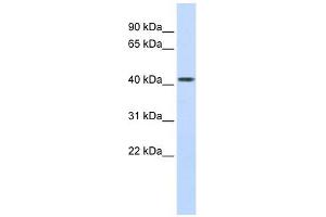 Carboxypeptidase B2 antibody used at 1 ug/ml to detect target protein. (CPB2 Antikörper)