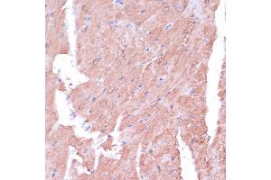 Immunohistochemistry (IHC) image for anti-Translocase of Inner Mitochondrial Membrane 8 Homolog B (TIMM8B) (AA 16-98) antibody (ABIN7270928)