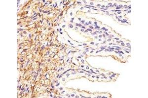 Immunohistochemical analysis of paraffin-embedded human prostate section using ATF6 beta antibody at 1:25. (ATF6B Antikörper  (AA 560-589))