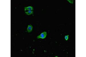 Immunofluorescent analysis of HepG2 cells using ABIN7153002 at dilution of 1:100 and Alexa Fluor 488-congugated AffiniPure Goat Anti-Rabbit IgG(H+L) (FNIP1 Antikörper  (AA 221-508))