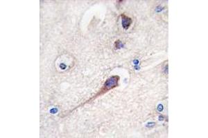 Image no. 3 for anti-Hippocalcin (HPCA) (N-Term) antibody (ABIN357112) (Hippocalcin Antikörper  (N-Term))
