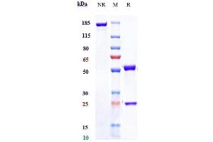 Anti-IL-20 Reference Antibody (fletikumab) on SDS-PAGE under reducing (R) condition.