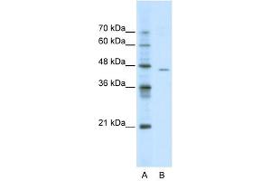 ACCN4 antibody used at 0. (ACCN4 Antikörper  (N-Term))