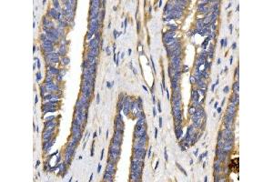 IHC analysis of SLC2A9 using anti-SLC2A9 antibody (ABIN7602338).