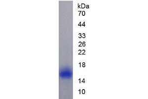 SDS-PAGE analysis of Rat Caveolin 1 Protein. (Caveolin-1 Protein)