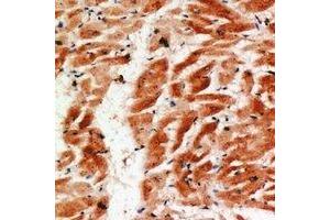 Immunohistochemical analysis of COX4-2 staining in human heart formalin fixed paraffin embedded tissue section.