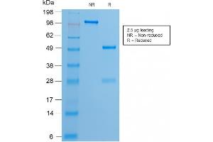 SDS-PAGE Analysis of Purified Estrogen Receptor, alpha Rabbit Recombinant Monoclonal Antibody (ESR1/2299R).