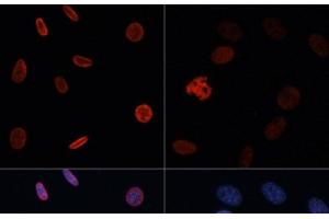 Immunofluorescence analysis of NIH/3T3 cells using Acetyl-Histone H2B-K15 Polyclonal Antibody at dilution of 1:100. (Histone H2B Antikörper  (acLys15))