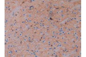 IHC-P analysis of Mouse Brain Tissue, with DAB staining. (Aquaporin 4 Antikörper  (AA 177-304))