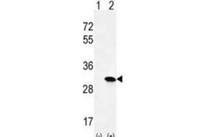Western Blotting (WB) image for anti-HRas proto-oncogene, GTPase (HRAS) antibody (ABIN2996311) (HRAS Antikörper)