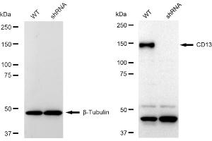 Western blotting analysis using CD13 antibody (ABIN7797548). (Rekombinanter CD13 Antikörper)