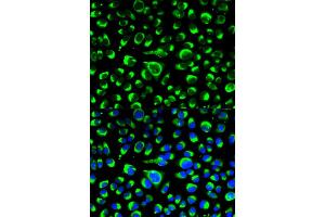 Immunofluorescence analysis of HeLa cells using P4HB antibody. (P4HB Antikörper)