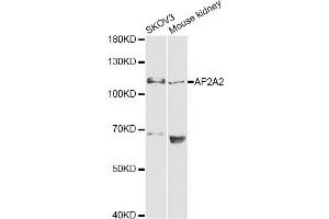 Western blot analysis of extracts of various cell lines, using AP2A2 antibody (ABIN6292468) at 1:1000 dilution. (AP2A2 Antikörper)