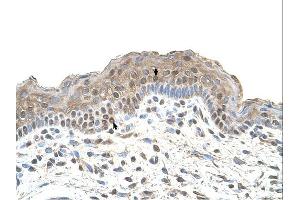 TAPBP antibody was used for immunohistochemistry at a concentration of 4-8 ug/ml. (TAPBP Antikörper)