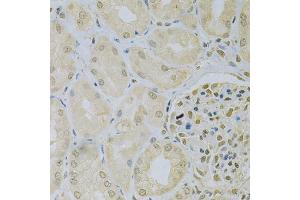 Immunohistochemistry of paraffin-embedded human kidney using CAMK1D Antibody (ABIN5975586) at dilution of 1/100 (40x lens). (CAMK1D Antikörper)